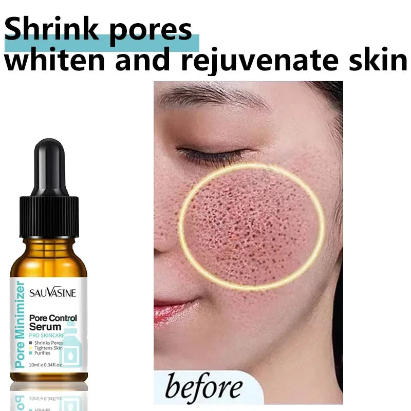 Poro Shrinking Soro Rosto Removendo Grandes Poros Aperto Reparando Poro Facial Minimizando Essência Cuidados com a Pele Beleza